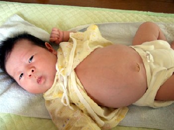 新生児 お腹 張る 医師監修 新生児のお腹がパンパンに 主な原因と対処法 19年11月29日 Biglobeニュース